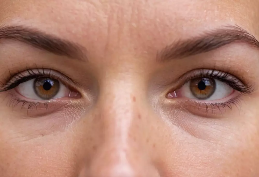 Eine Nahaufnahme der Mikronadel-Behandlung auf der Stirn, die das Gerät und die Interaktion mit der Haut in einem klinischen Umfeld zeigt. Das Foto wurde mit einem Makroobjektiv und detailliertem Fokus aufgenommen.