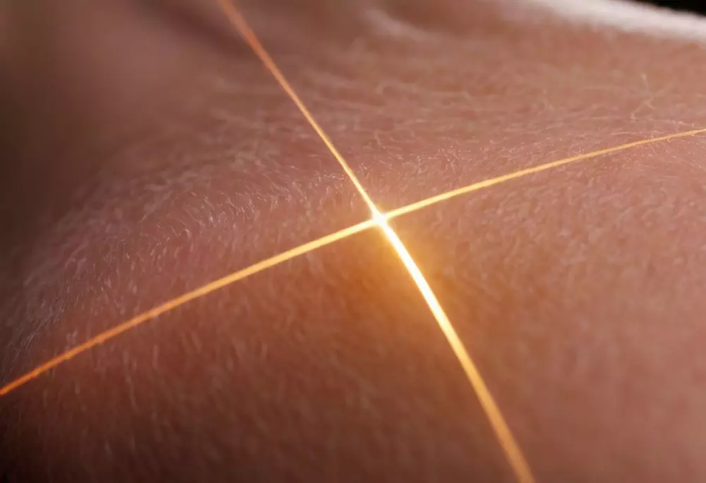 Close-up of a laser device on skin, illustrating collagen fibers, Photographic with detailed macro lens and soft lighting.