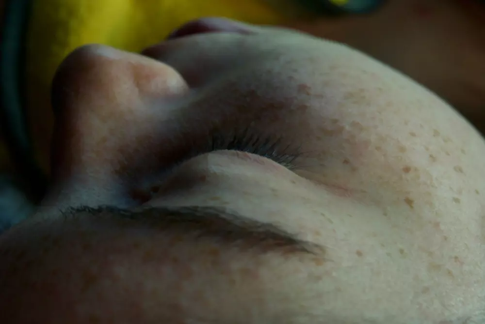 a close up of a person with freckles on their face