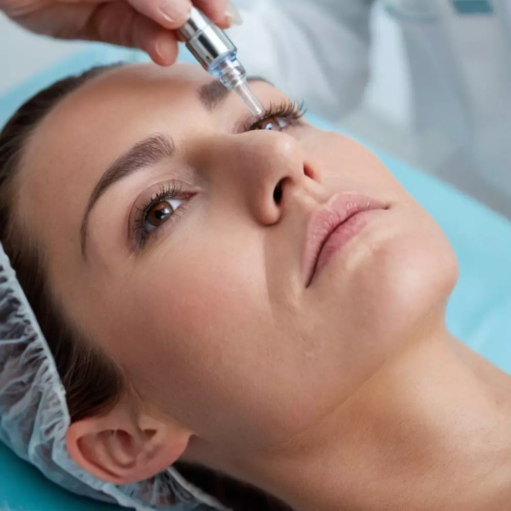 Primer plano de las manos de un profesional realizando mesoterapia con un microneedle en el rostro de un paciente en un entorno clínico, enfocándose en el procedimiento y el ambiente estéril, capturado en un estilo fotográfico de alta resolución y enfoque nítido.