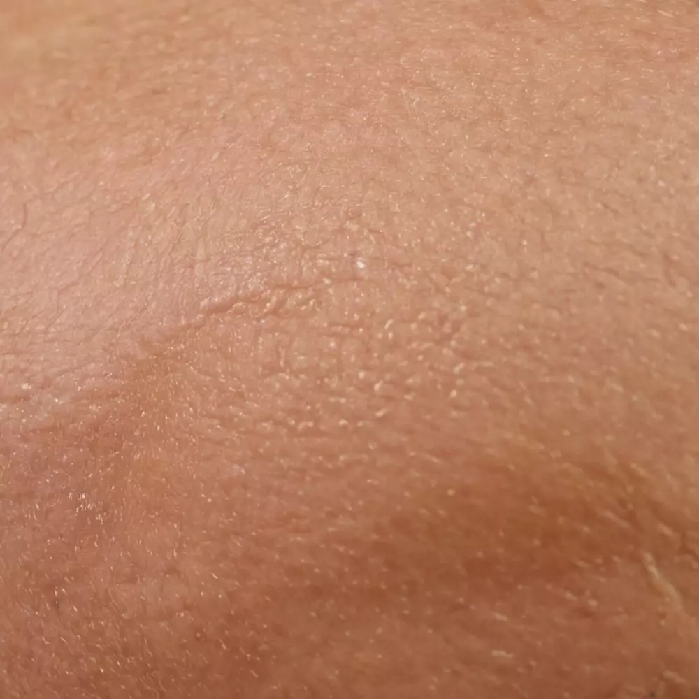 Nahaufnahme eines sanft gezwickten Hautstücks, um die Elastizität zu zeigen, mit Fokus auf der Textur und den natürlichen Farben der Haut, aufgenommen im Tageslicht, um die Details zu betonen, in einem fotografischen Stil.