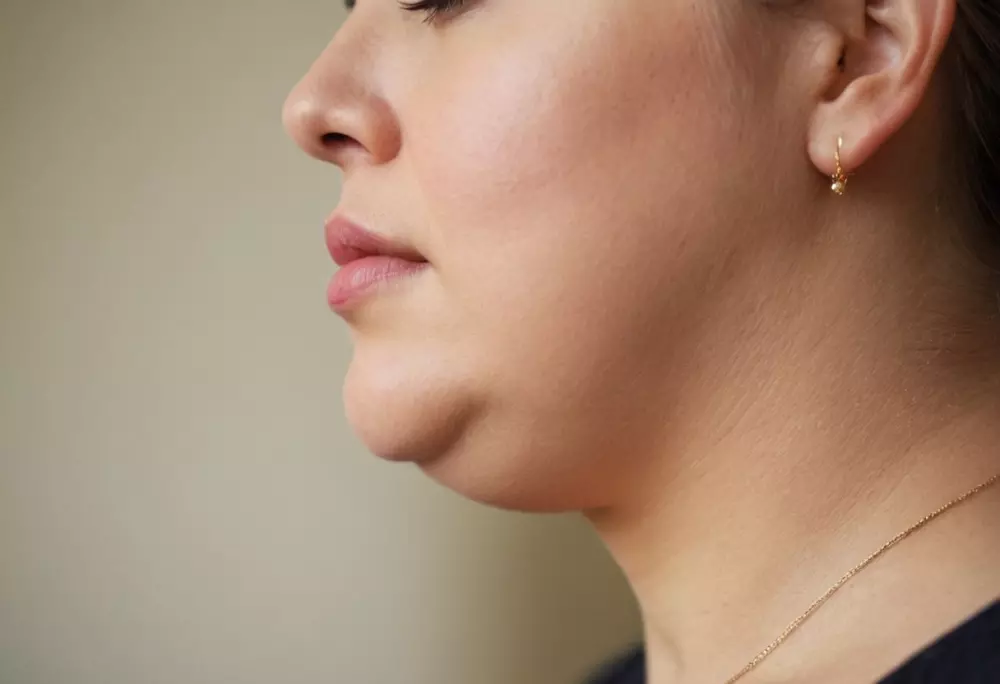 Foto en primer plano del cuello de una persona mostrando papada, con iluminación natural, enfocada en la barbilla y el área del cuello. Imagen fotográfica detallada con enfoque nítido y alta resolución.