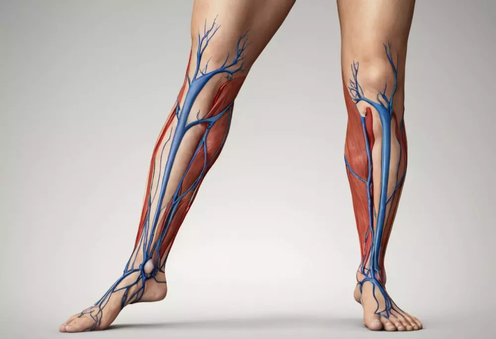 Darstellung des menschlichen Venensystems in den Beinen, Hervorhebung von Bereichen, die typischerweise von Venenschwäche betroffen sind, in einer sauberen klinischen Umgebung, Digitale Illustration, erstellt mit detaillierter digitaler Zeichnung, die sich auf Genauigkeit und Klarheit konzentriert.
