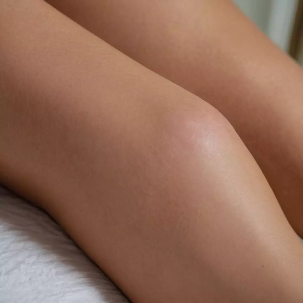 Nahaufnahme von geschwollenen Beinen aufgrund von venösen Problemen, wobei die Schwellung und die Hautbeschaffenheit betont werden, in einer ruhigen häuslichen Umgebung, fotografisch, mit detailliertem Fokus, um Hautdetails zu zeigen.