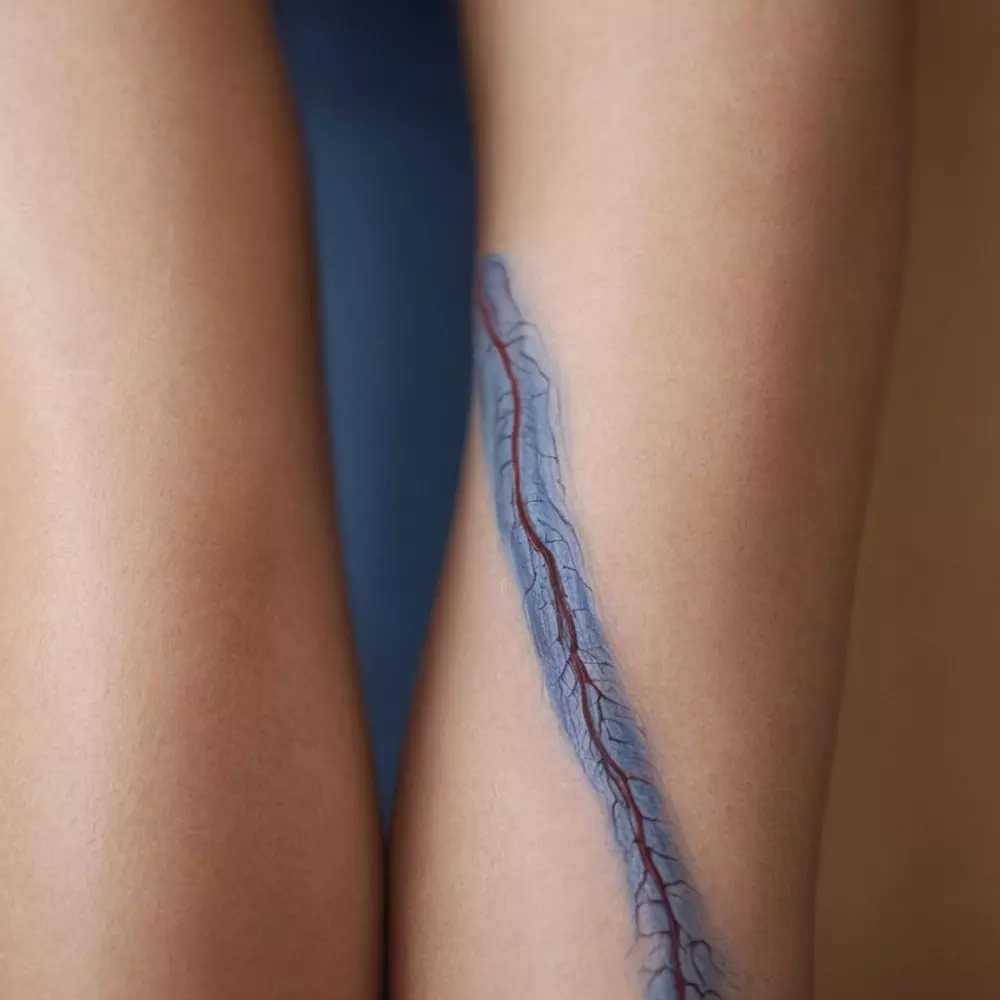 Nahaufnahme von Krampfadern an einem Bein, die die geschwollenen, blau gefärbten Venen deutlich gegen einen hellen Hautton hervorheben. Fotografie, Makrofotografie mit Fokus auf Textur und Farbkontrast im natürlichen Licht.