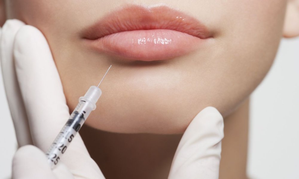 Big Lip Injections: Exploring Your Options for Fuller Lips | Dr. Linde blog