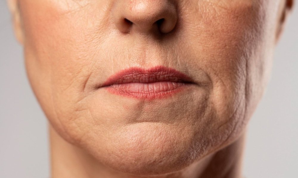 Saggy Skin Solutions: Comprehensive Guide to Firmer Skin | Dr. Linde blog