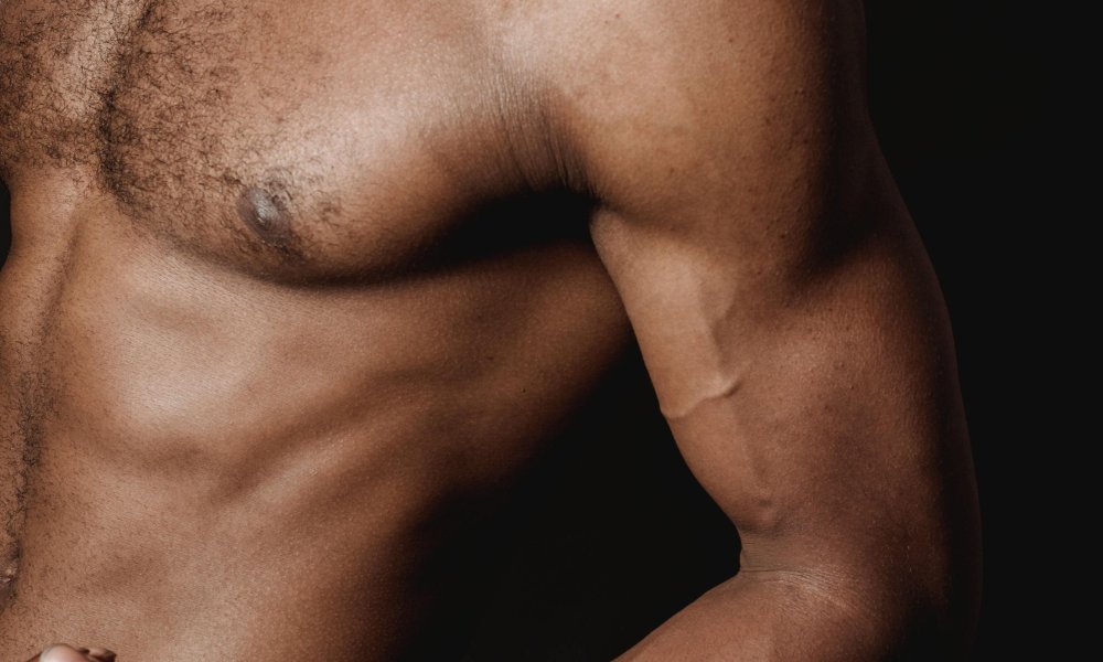 Effective Arm Exercises for Fat Arms: A Comprehensive Guide | Dr. Linde ...