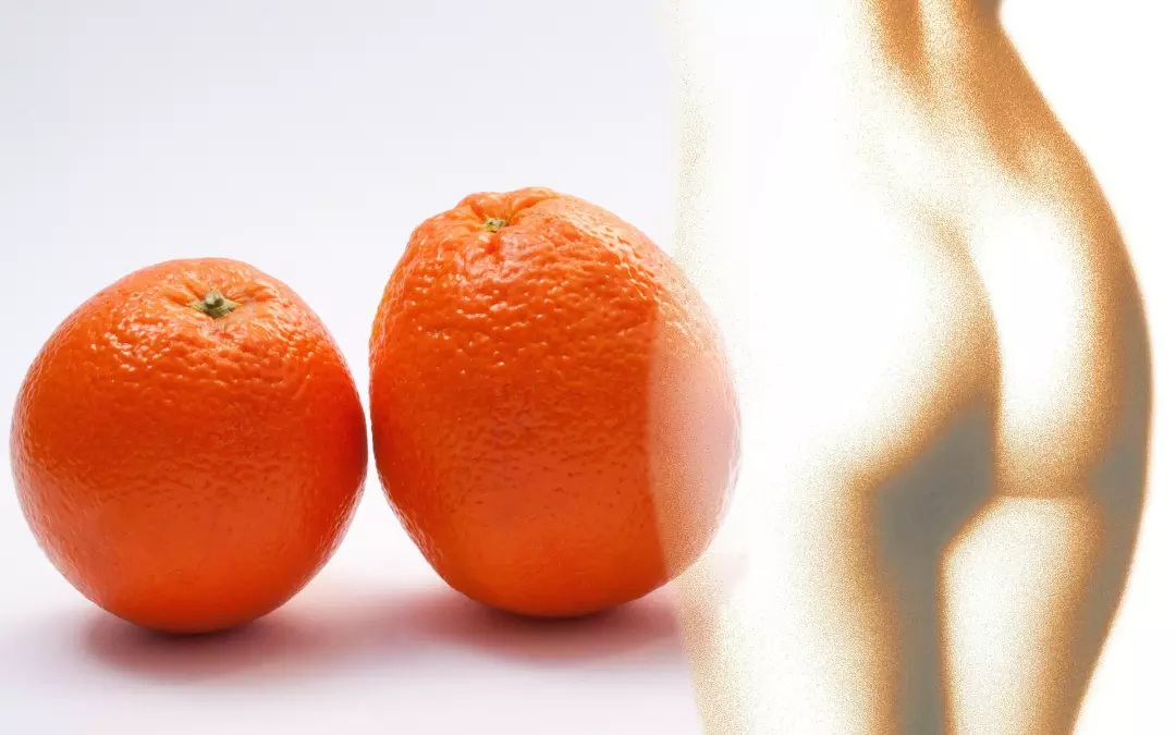 3 Hausmittel gegen Cellulite