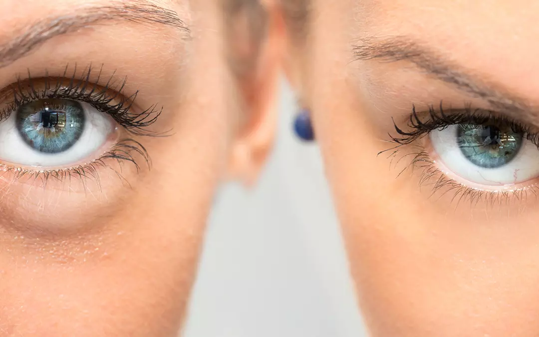 Der perfekte Augenaufschlag: Wimpernverl&auml;ngerung und -verdichtung im &Uuml;berblick