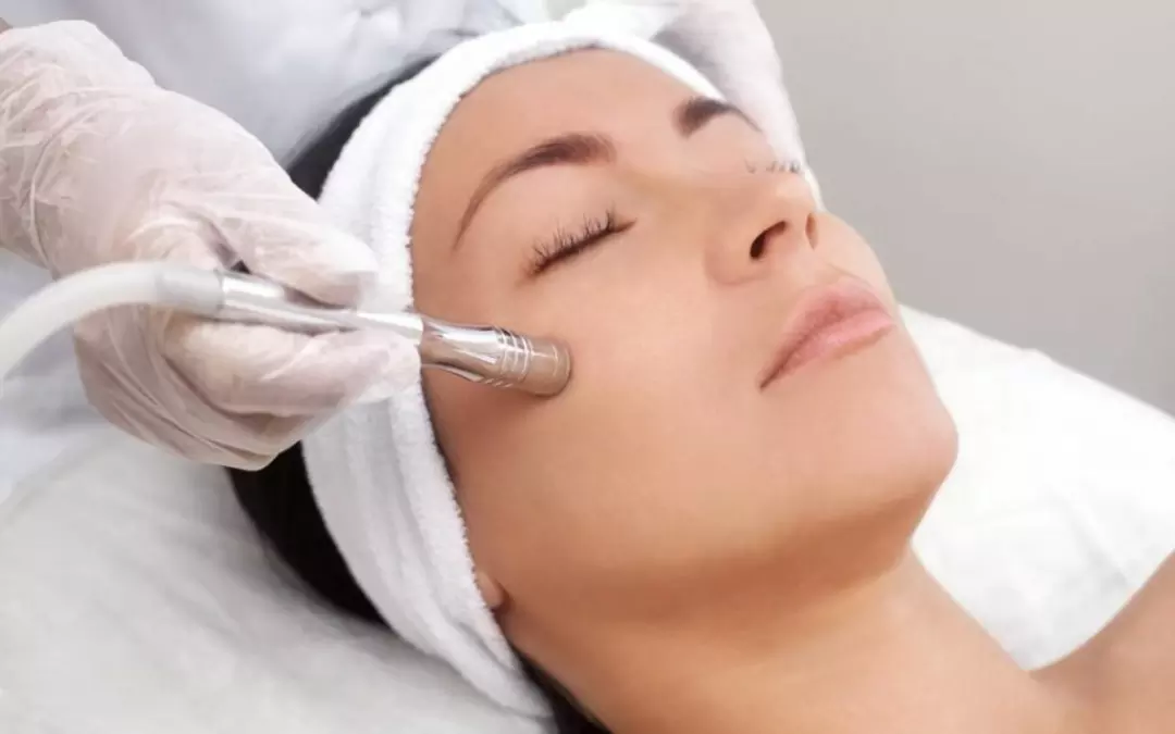 Wie oft kann ich die Microdermabrasion wiederholen?
