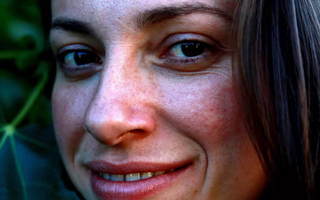 Top Under Eye Wrinkle Treatment Strategies Unveiled