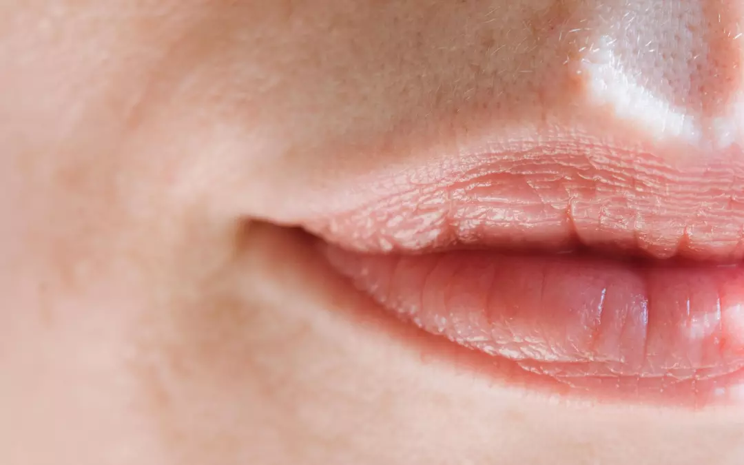 Hyaluronic Acid Injections Face: A Comprehensive Guide