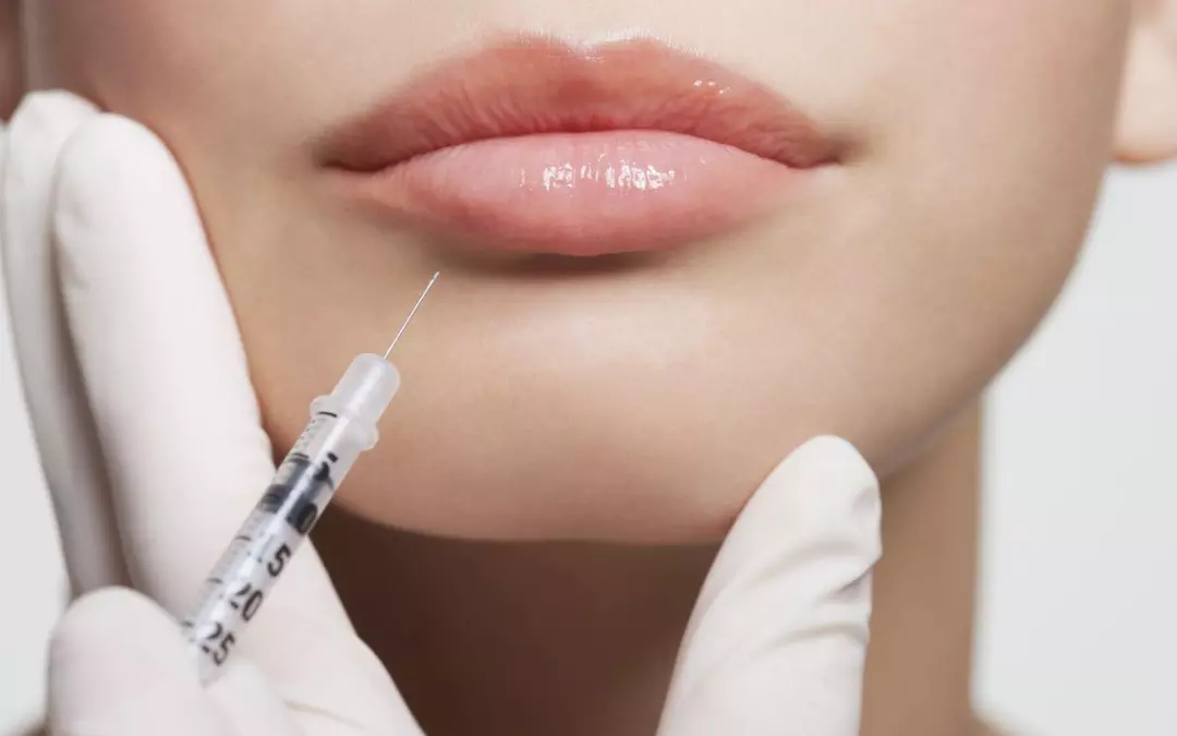 Big Lip Injections: Exploring Your Options for Fuller Lips