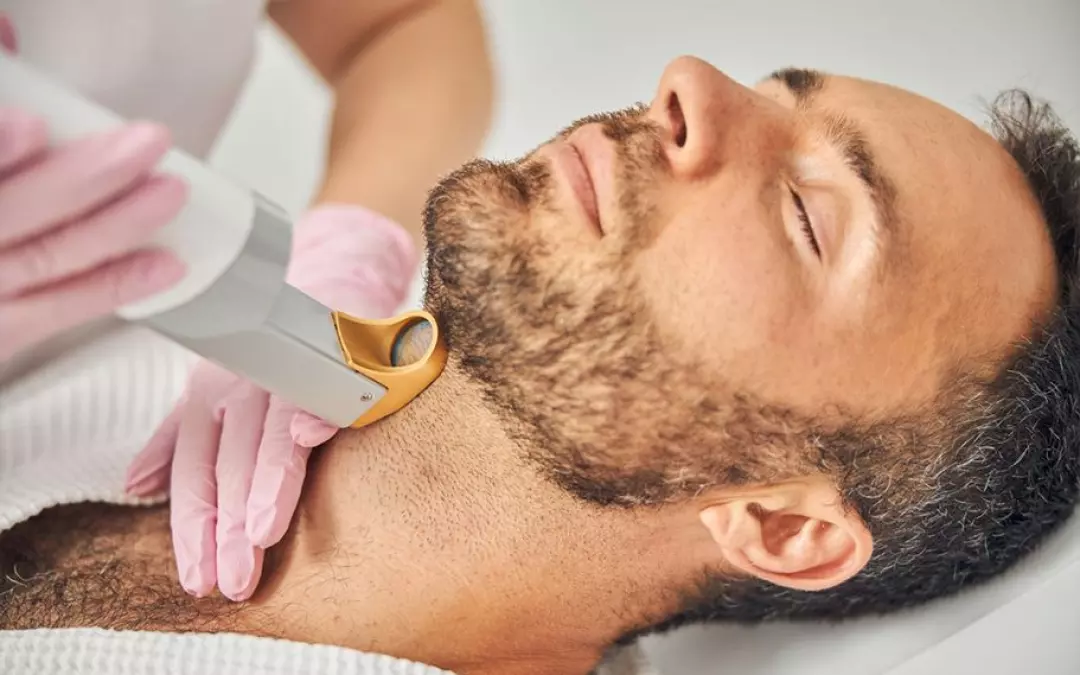 Comprehensive Guide to Facial Hair Laser Treatment