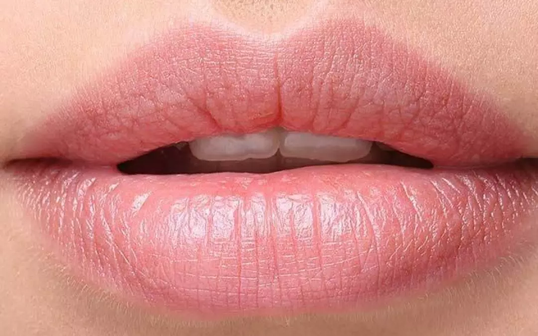 Fuller Lips Without Fillers: Your Natural Guide