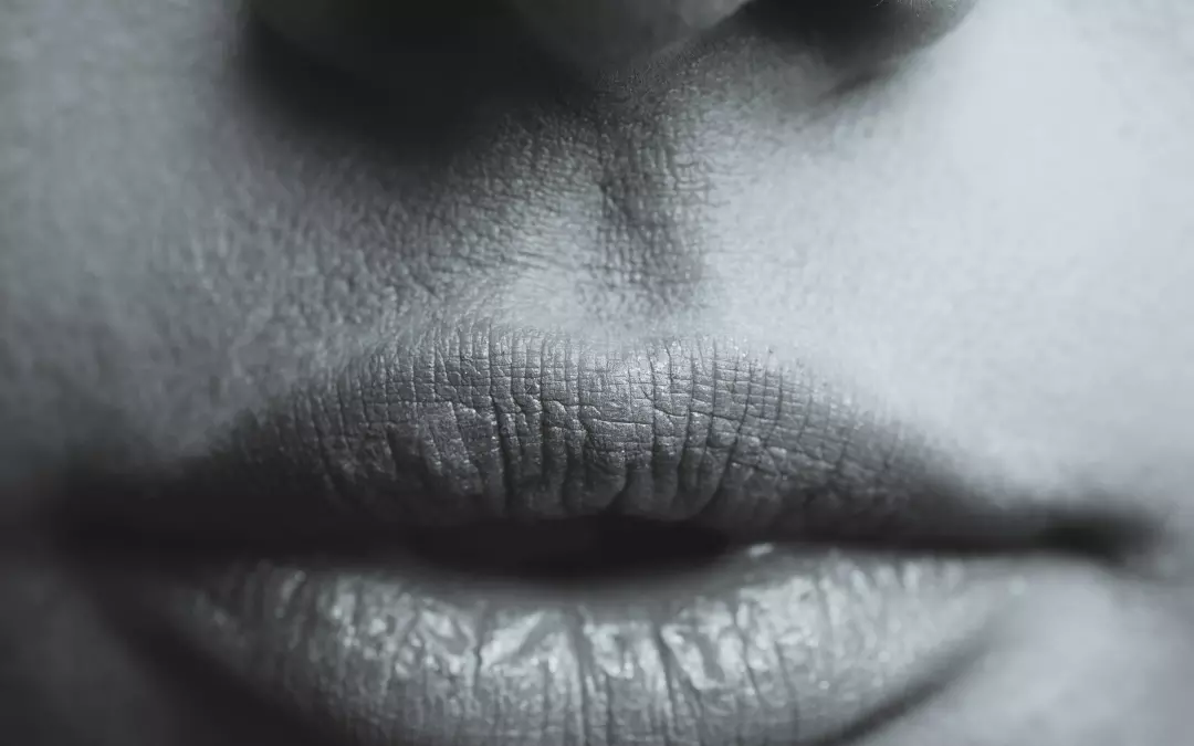 Lip Wrinkles: Causes, Treatments, and Effective Solutions