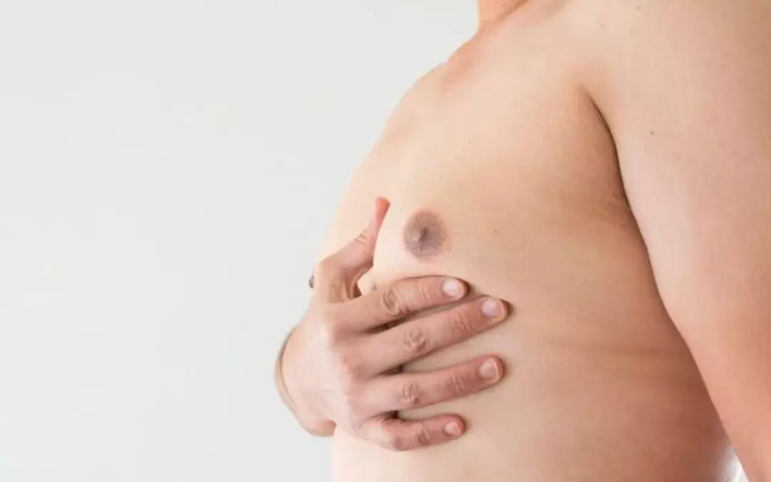 Exploring Fat Freezing Man Boobs: A Comprehensive Guide