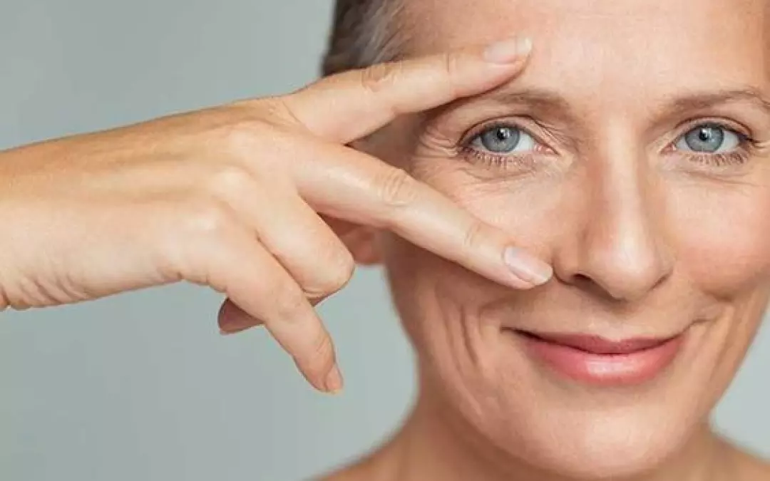 Everything You Need to Know About Radiesse Injections