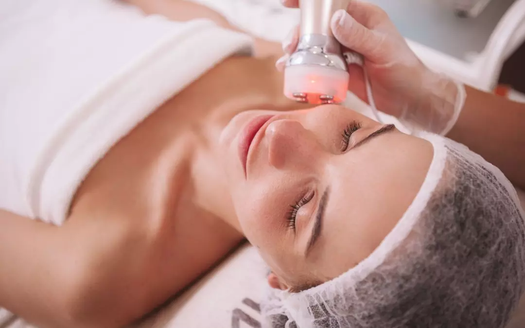 Radiofrequency Facial: Your Ultimate Guide to Rejuvenation