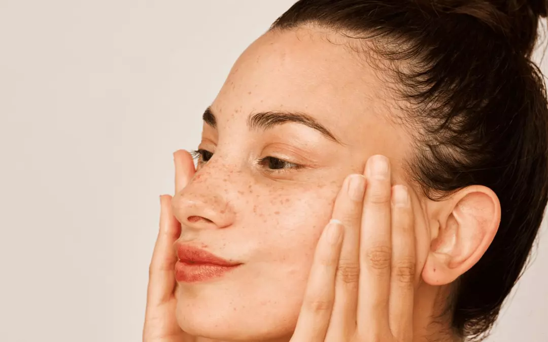 Essential Insights on Laser Skin Tightening