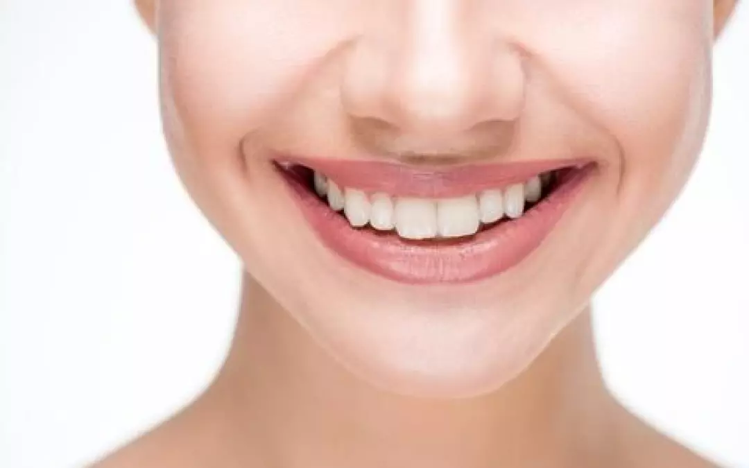 Ultimate Guide to Get Rid of Smile Lines Effectively