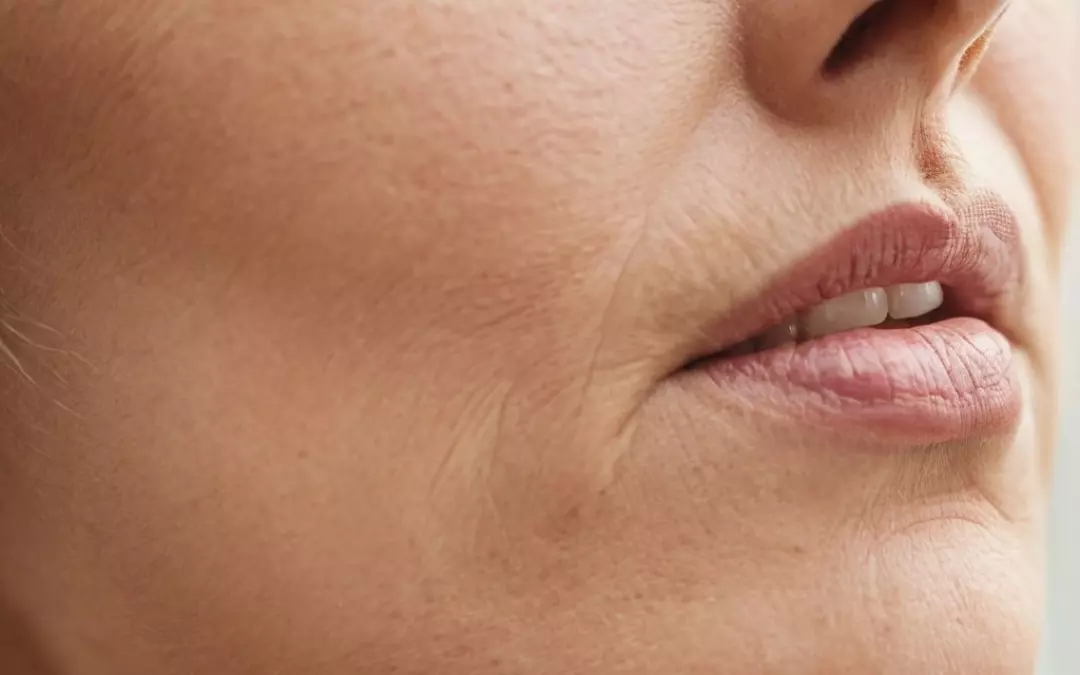 Chin Threads: A Comprehensive Guide to Modern Thread Lifts