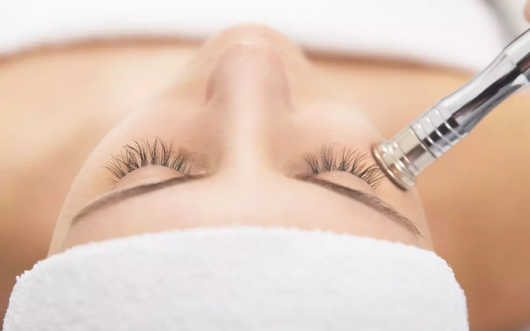 Comprehensive Guide to Laser Therapy for Facial Veins