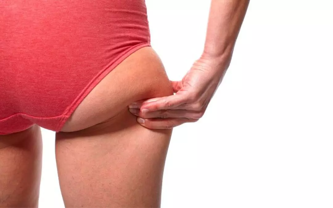 Comprehensive Guide to Remove Fat from Buttocks Surgery