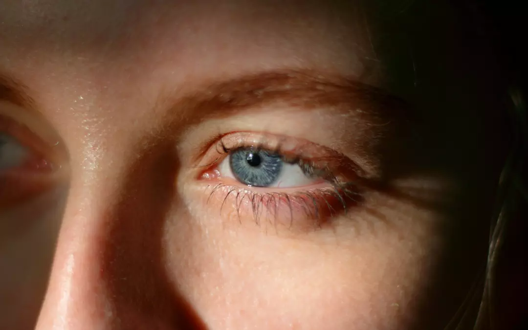 Falten unter den Augen Hyaluron Vorher Nachher