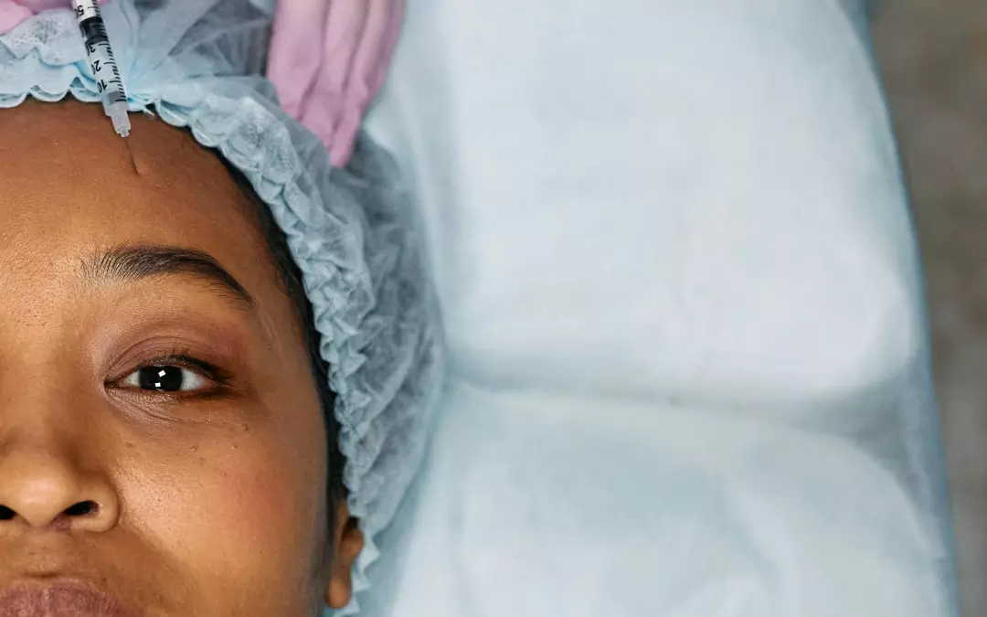 Botulinumtoxin Stirnfalten: Gl&auml;ttung und Behandlungstipps