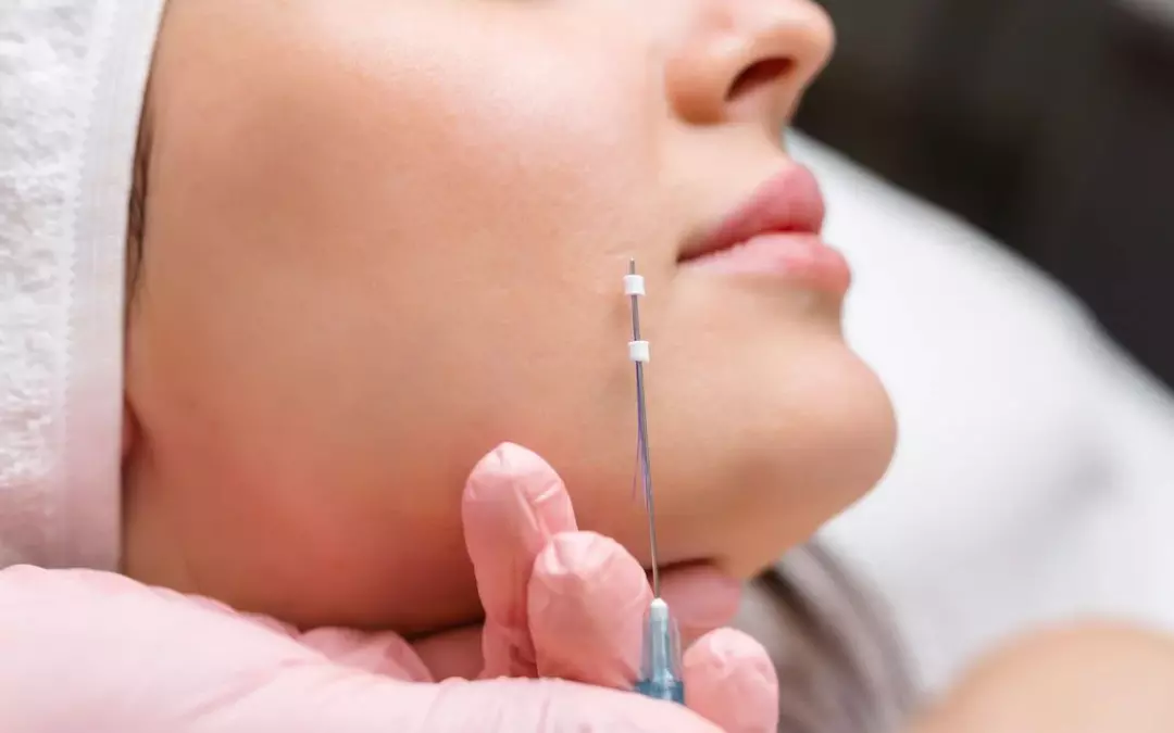 Exploring Collagen Threads: A Comprehensive Guide