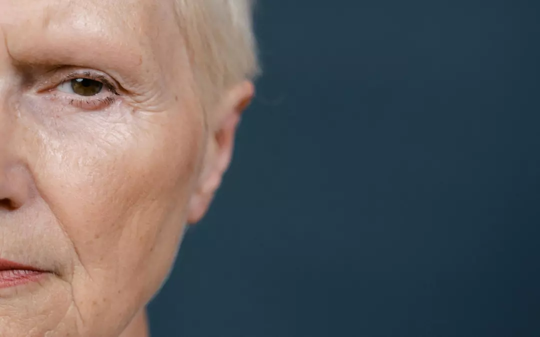 Understanding Why Face Skin is Loose and Solutions