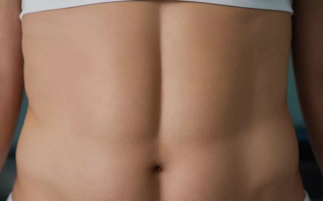 Unveiling Ab Liposuction: What You Need to Know
