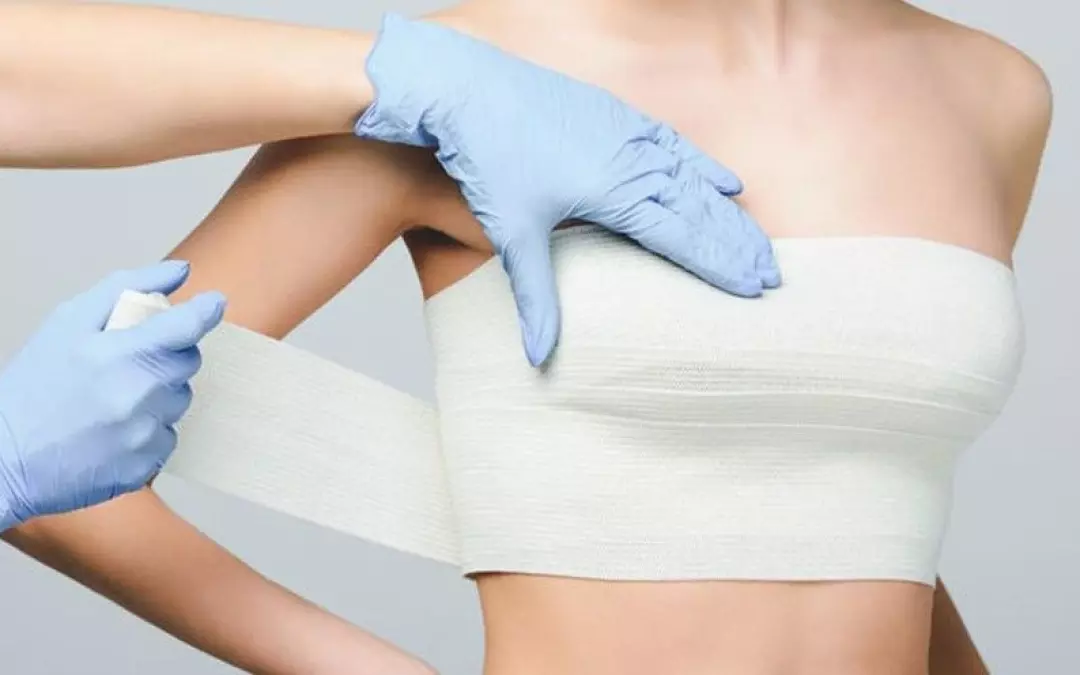 Fat Grafting Breast Augmentation: Insights and Overview