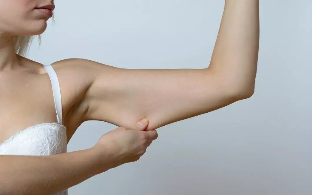 Understanding Arm Lipo and Lift: A Comprehensive Guide