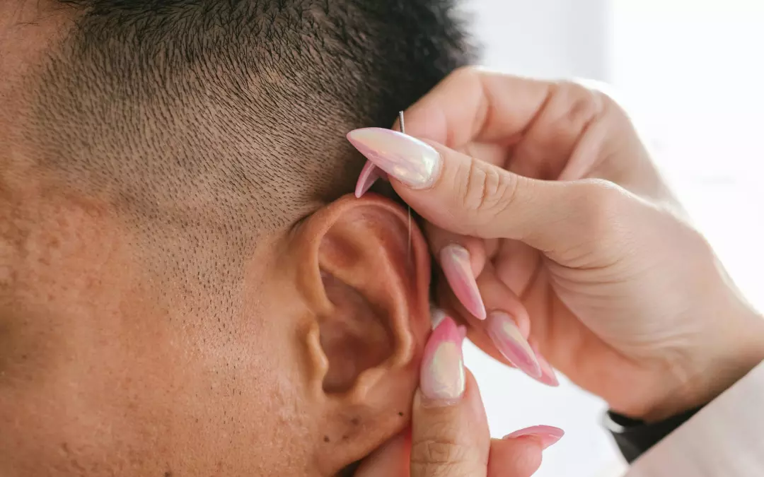 Auriculoterapia para bajar de peso: &iquest;C&oacute;mo funciona?