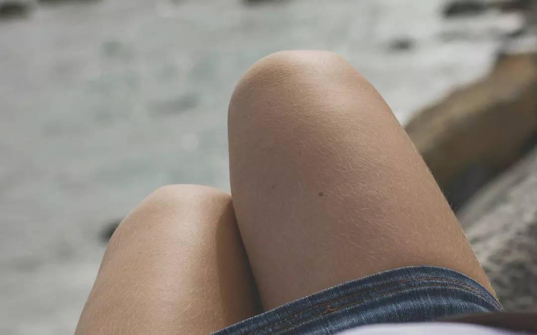 &iquest;Se puede quitar la celulitis de las piernas? Descubre c&oacute;mo