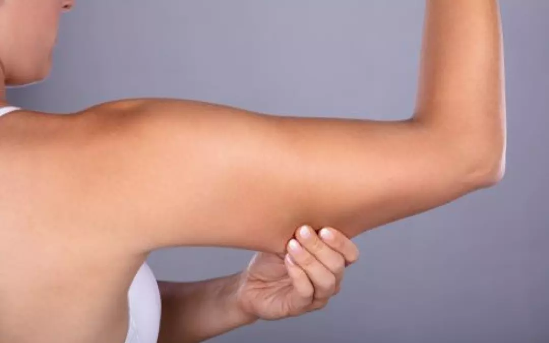 Tricep Fat Removal Surgery: Essential Insights and Options