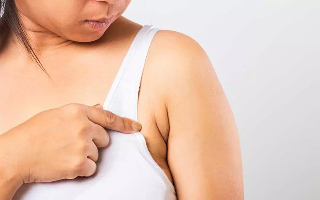 Understanding Arm Pit Lipo: A Comprehensive Guide