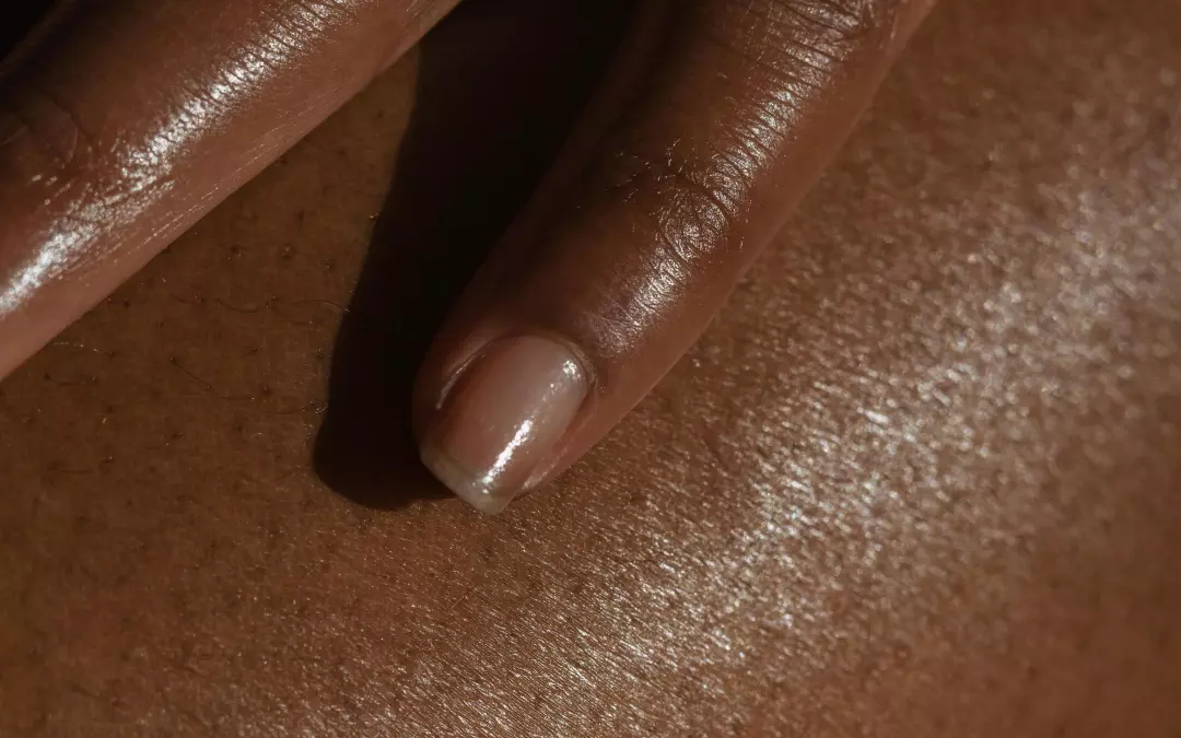 Alles &uuml;ber Cellulite Behandlungen: Was Sie wissen m&uuml;ssen