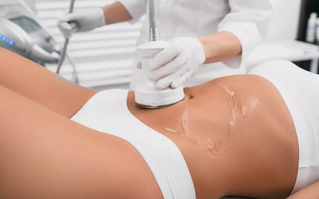 Your Guide to Laser Lipo and Fat Reduction