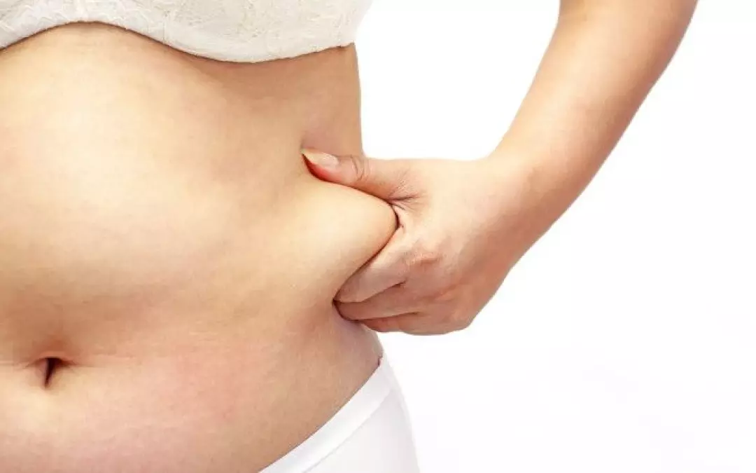 Lipo Cost: Your Essential Guide to Liposuction Expenses