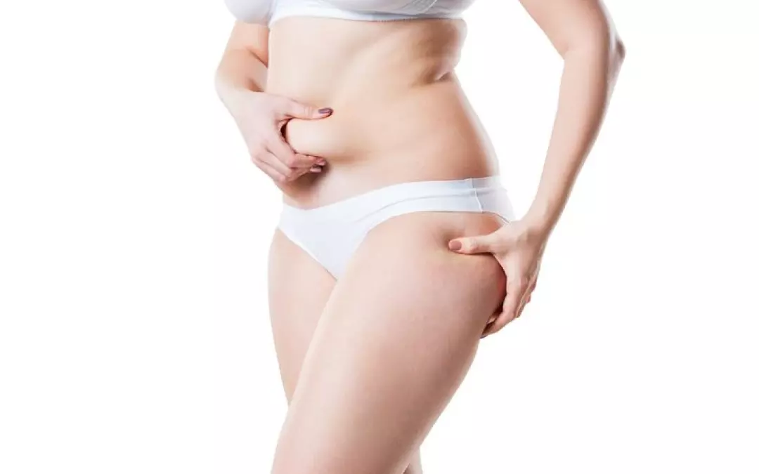 Comprehensive Guide to Hip Fat Removal Techniques and Tips