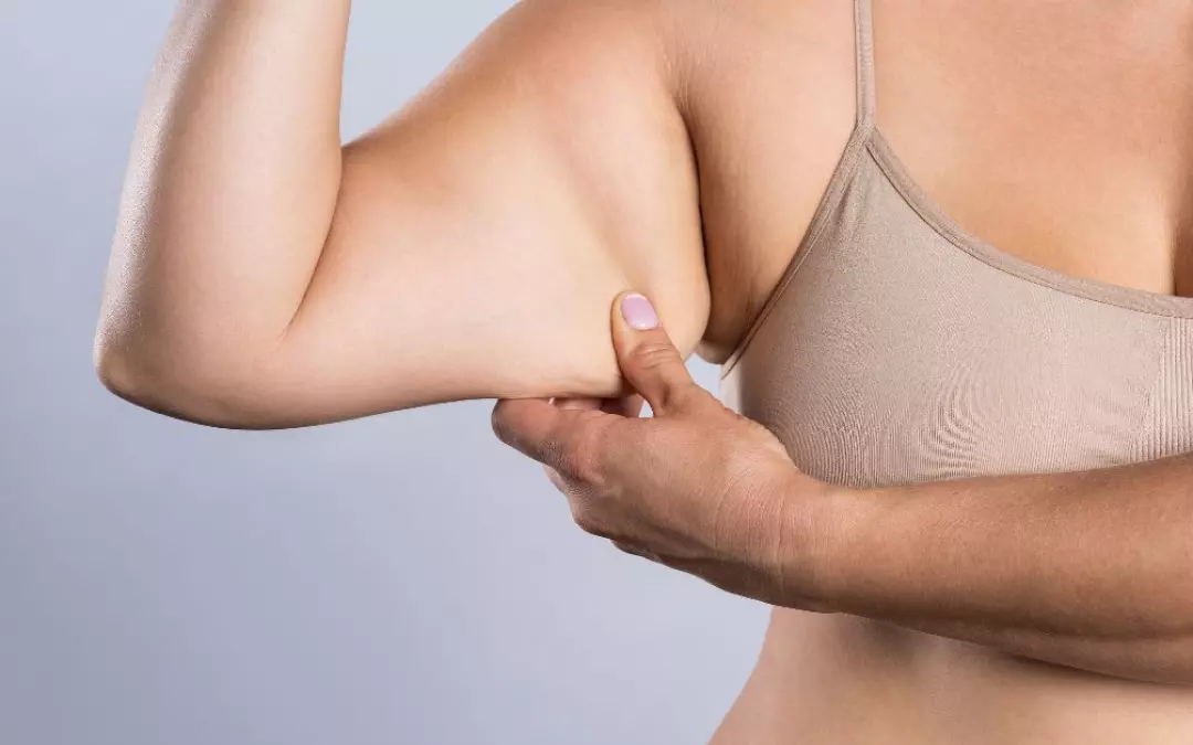 Effective Exercise for Flabby Arms: Your Ultimate Guide