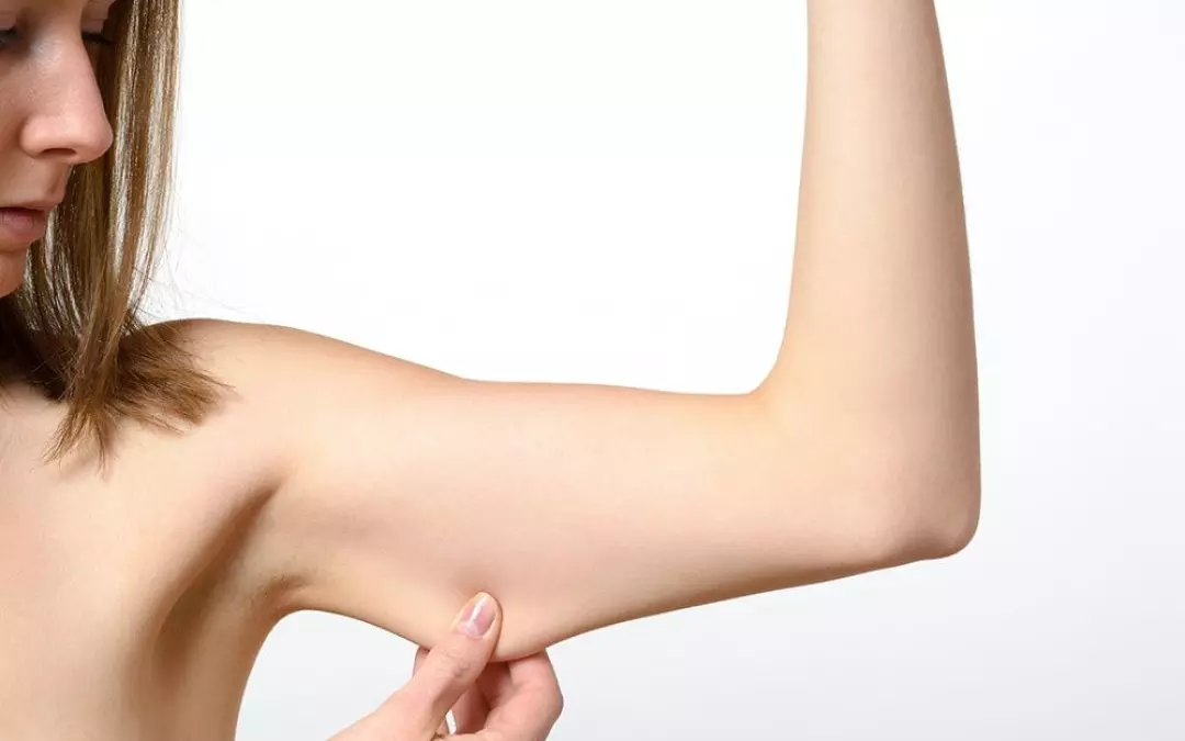 Effective Ways to Get Rid of Bat Wings Without Surgery