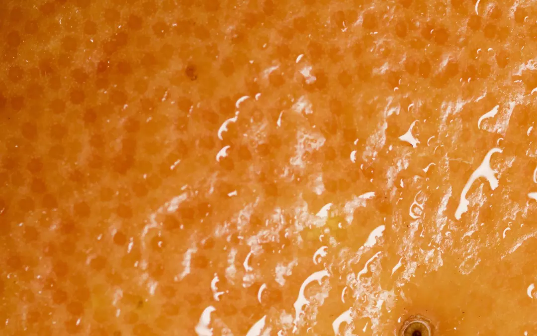 Kryolipolyse gegen Cellulite: Was Sie wissen m&uuml;ssen