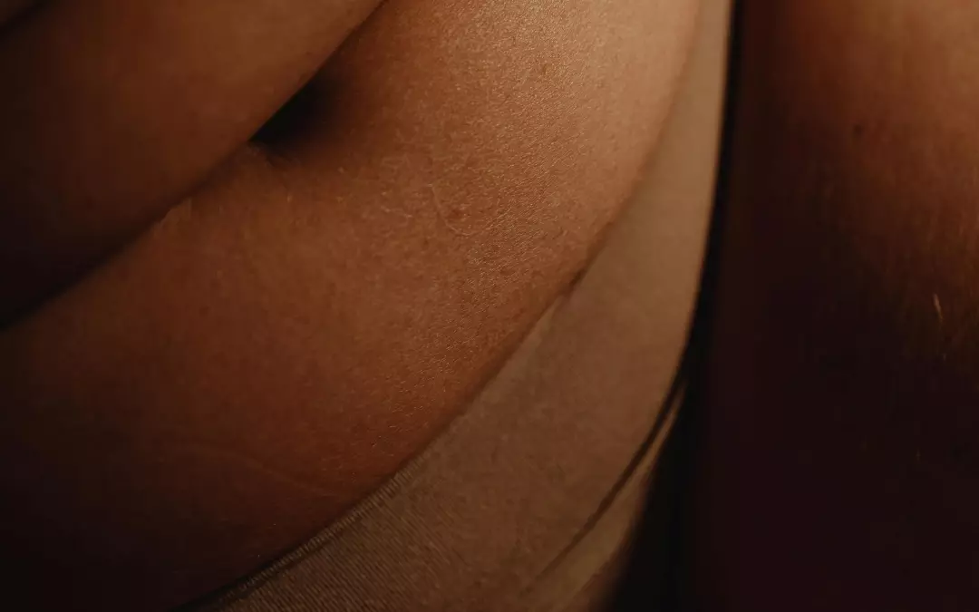 &Uuml;bersch&uuml;ssige Haut nach Abnehmen: Ursachen und L&ouml;sungen