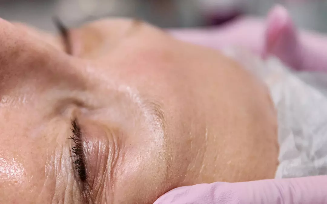 Contraindicaciones de Carboxiterapia: Informaci&oacute;n Clave