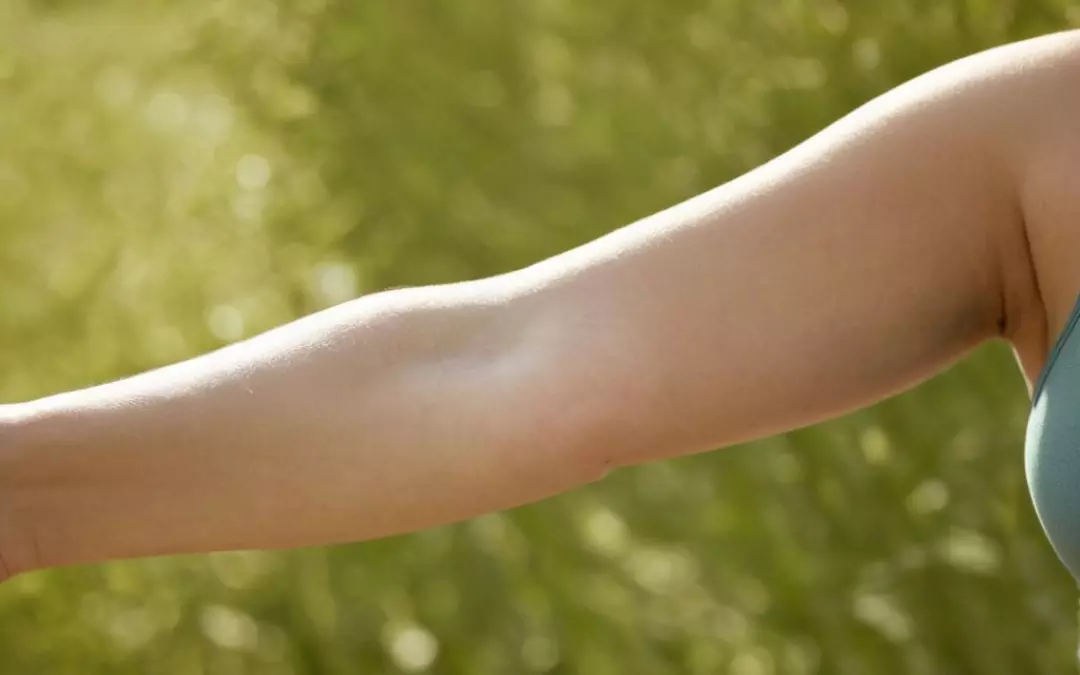 Understanding and Managing Bat Wings Arms Effectively